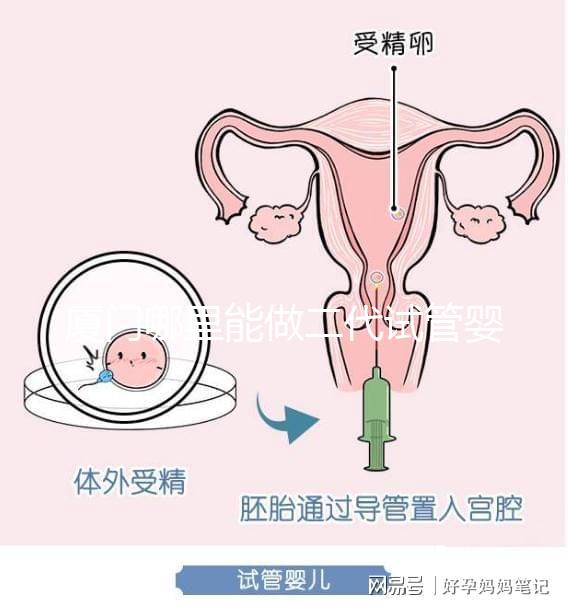 廈門哪里能做二代試管嬰兒，做一次成功率和費用多少？