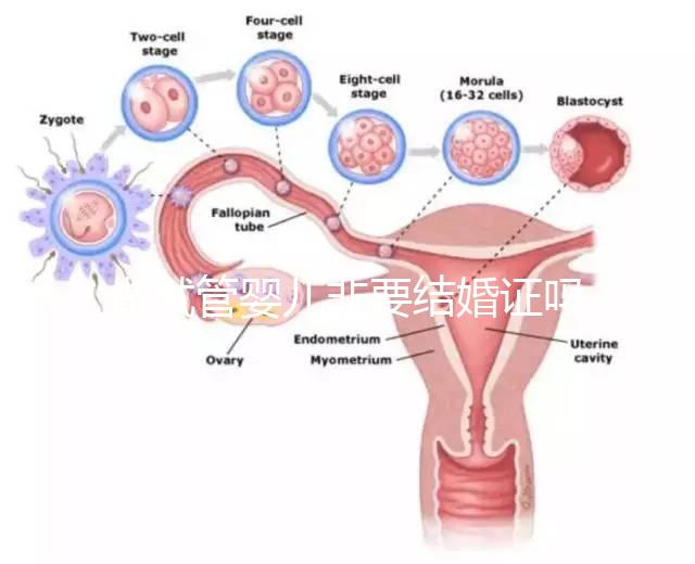 做試管嬰兒非要結婚證嗎？做試管嬰兒一定需要結婚證嗎？