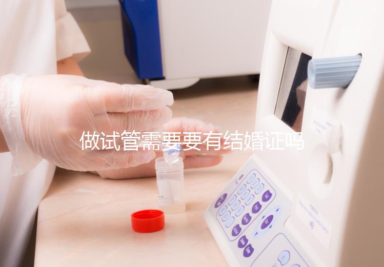 做試管需要要有結婚證嗎？