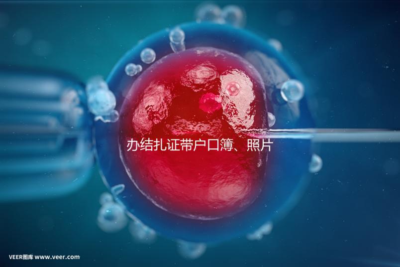 辦結(jié)扎證帶戶口簿、照片作用不大，要一樣就足夠~