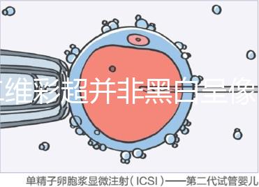 二維彩超并非黑白呈像，通過檢查還能看清胎兒五官