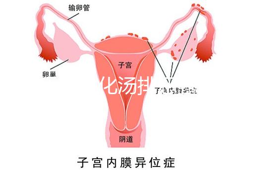 產后喝生化湯排惡露會使寶寶拉肚子?醫(yī)生:時間沒用對