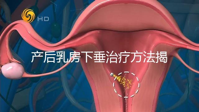 產(chǎn)后乳房下垂治療方法揭秘，按摩手法再好也沒提前預防有用