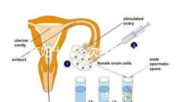 產(chǎn)婦十大一次性內(nèi)褲品牌排行揭曉，全棉時(shí)代質(zhì)量如何看這