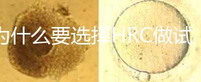 為什么要選擇HRC做試管?這6大優勢看完就知道答案