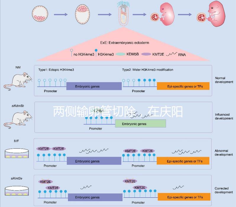 兩側輸卵管切除，在慶陽有醫院能做試管嬰兒嗎？