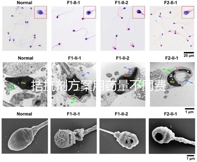 拮抗劑方案用藥量不同費(fèi)用也不一樣，看看大家都花了多少
