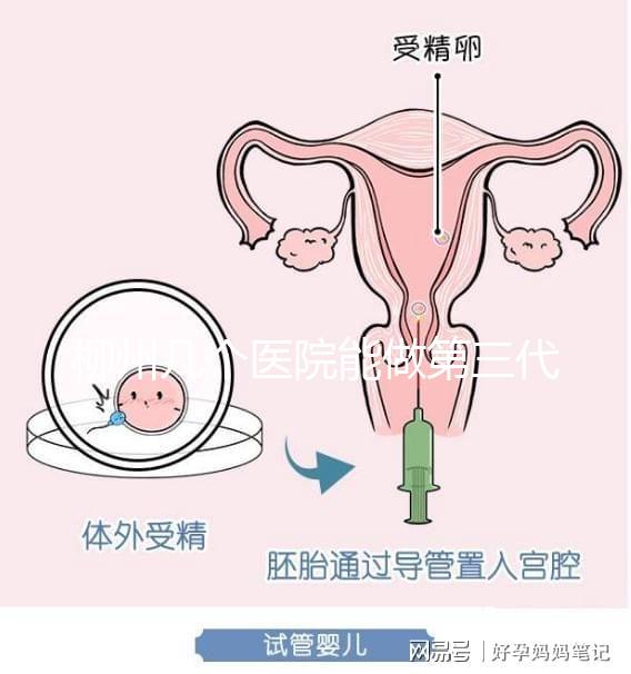 柳州幾個醫院能做第三代試管嬰兒？詳細的費用成功率都在這
