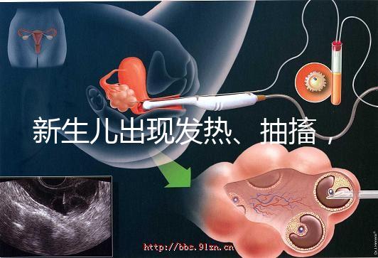 新生兒出現(xiàn)發(fā)熱、抽搐，很可能是胎毒的表現(xiàn)