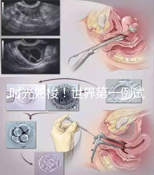 時(shí)光如梭!世界第一例試管嬰兒路易絲·布朗已經(jīng)41歲啦