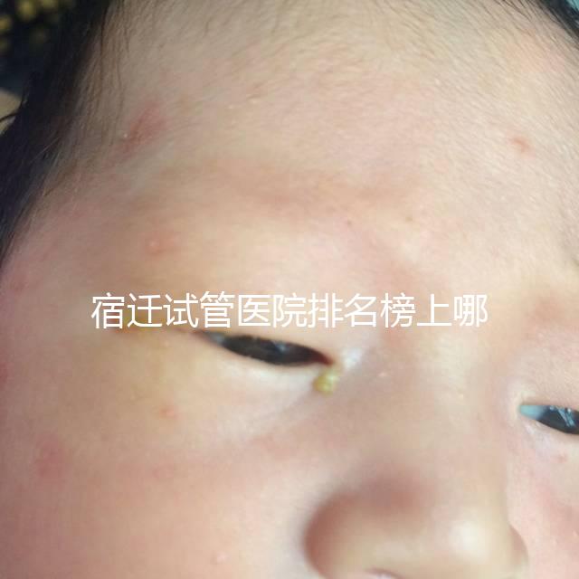 宿遷試管醫(yī)院排名榜上哪家好,不造助孕成功率和費(fèi)用別亂選