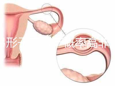 弓形子宮流產(chǎn)概率高非個(gè)例！罪魁禍?zhǔn)资沁@個(gè)原因