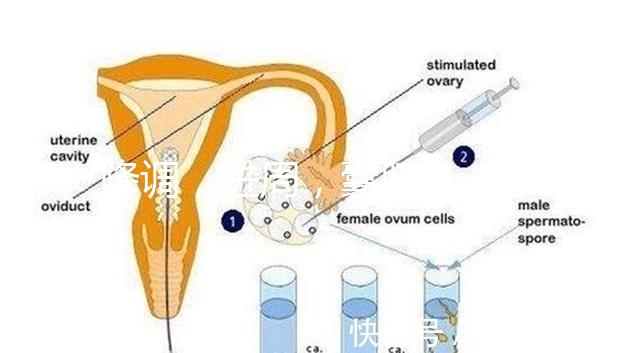 降調，進周，囊胚……這些試管嬰兒助孕術語你都懂嗎？