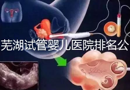 蕪湖試管嬰兒醫院排名公開，弋磯山醫院、蕪湖二院獲好評