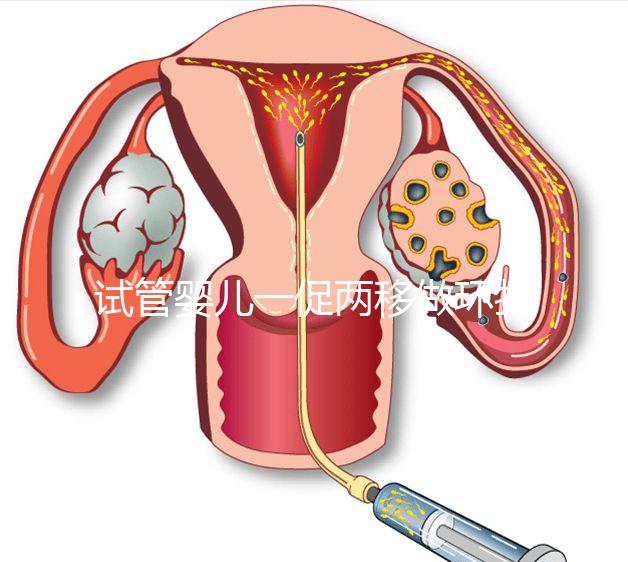 試管嬰兒一促兩移做環(huán)扎好看嗎？小心這些影響