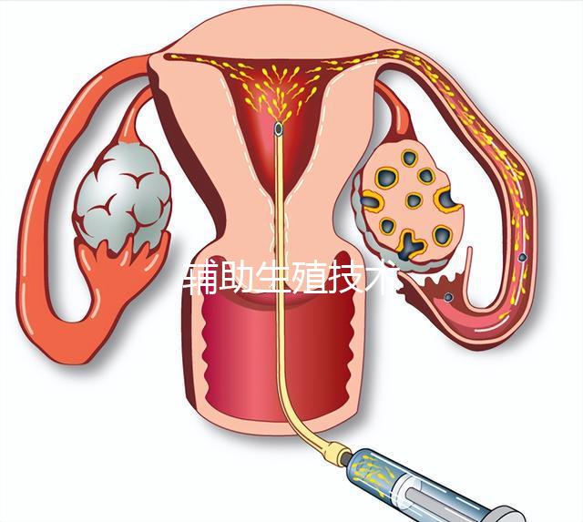輔助生殖技術(shù)
