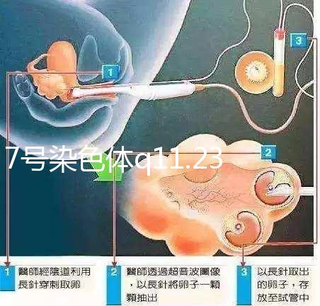 7號染色體q11.23重復綜合征患者智力水平低下，能治療嗎？