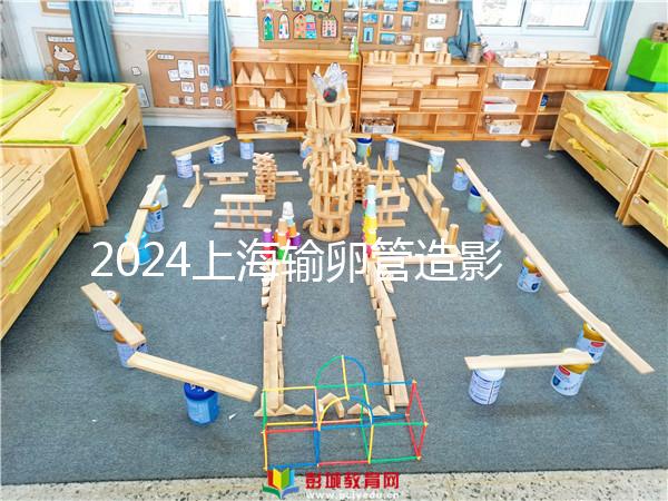 2024上海輸卵管造影檢查多少錢速覽,關鍵看能否報銷